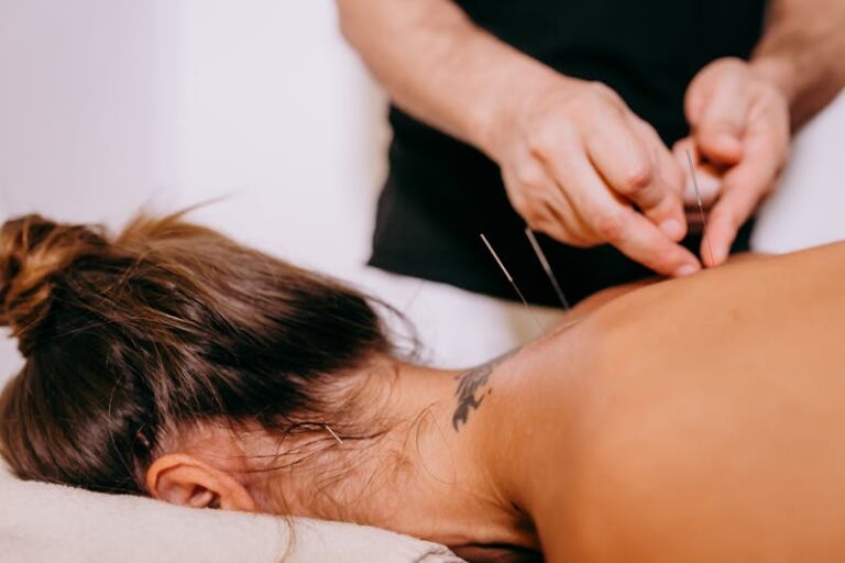 Dry needling therapy on patient